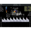 Аппарат УЗИ (сканер) GE Healthcare Voluson P8 medcub