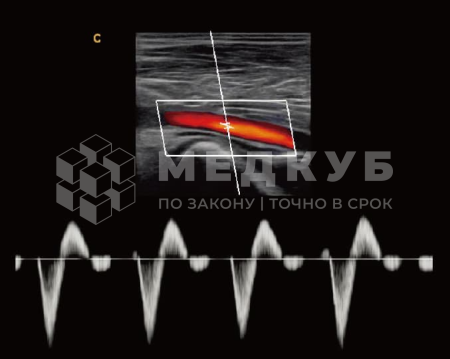Аппарат УЗИ (сканер) Chison Qbit 8 medcub