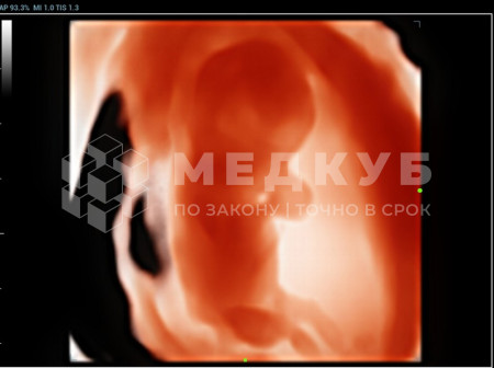 Аппарат УЗИ (сканер) Mindray Resona 6 medcub