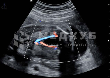 Аппарат УЗИ НПО Сканер РуСкан 65 medcub