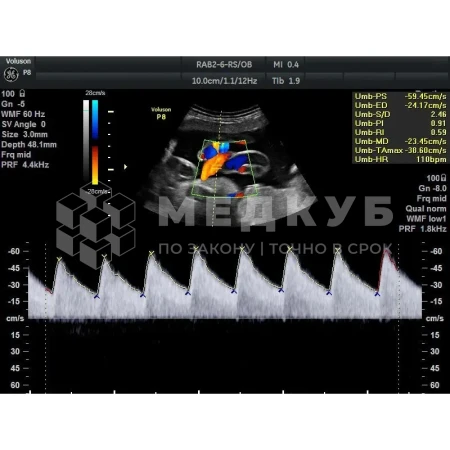 Аппарат УЗИ (сканер) GE Healthcare Voluson P8 medcub