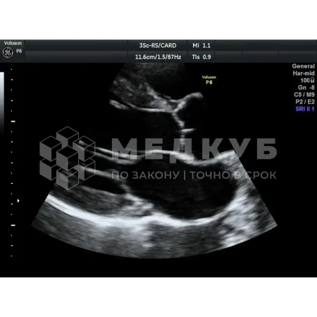 Аппарат УЗИ (сканер) GE Healthcare Voluson P8 medcub