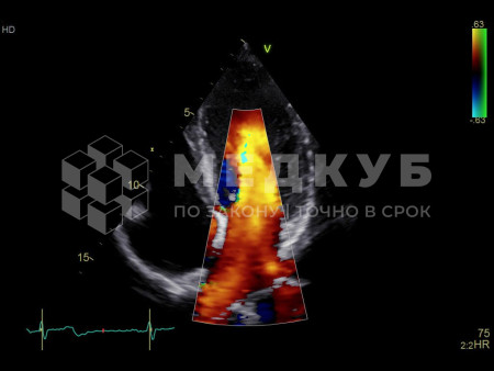 Аппарат УЗИ (сканер) GE Healthcare Vivid S70N medcub