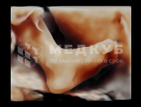 Аппарат УЗИ (сканер) Mindray Resona 6 medcub