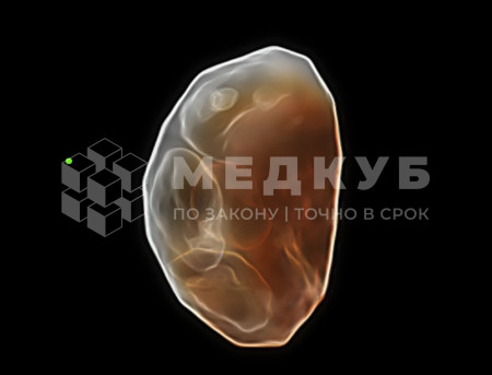 Аппарат УЗИ (сканер) Mindray Resona 6 medcub