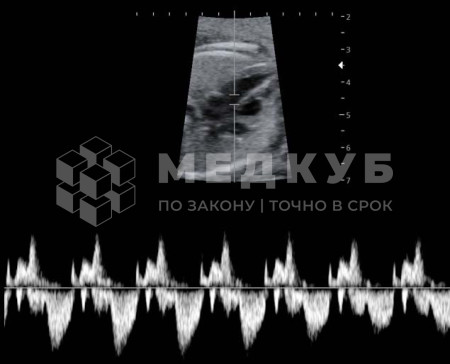 Аппарат УЗИ НПО Сканер РуСкан 65М medcub