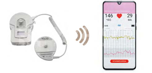 Система БИОСС ФМП-01 для дистанционного кардиотокографического мониторирования (фетальный монитор) medcub
