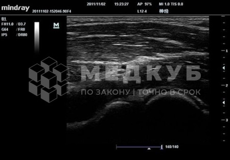 Портативный аппарат УЗИ Mindray TE7 (планшет) medcub