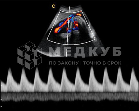 Аппарат УЗИ (сканер) Chison Qbit 8 medcub