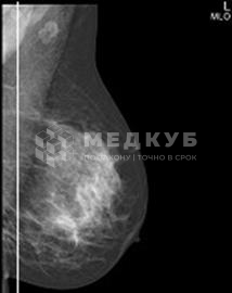 Маммограф РенМедПром Омикрон+АРМ врача medcub