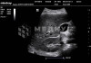 Портативный аппарат УЗИ Mindray TE7 (планшет) medcub