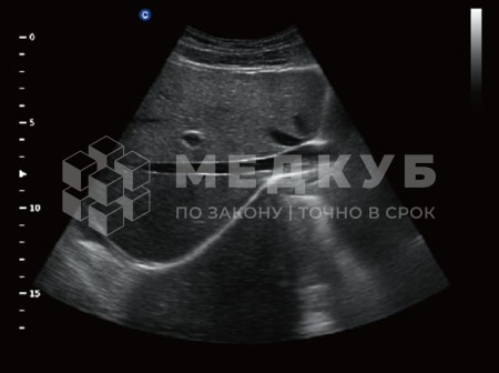 Аппарат УЗИ (сканер) Chison QBit 5 medcub