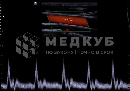 УЗИ-аппарат портативный НПО Сканер РуСкан 70П medcub