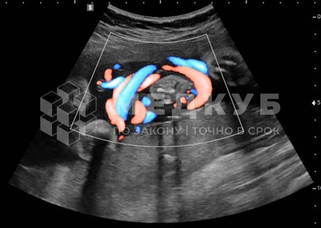 Аппарат УЗИ НПО Сканер РуСкан 65М medcub