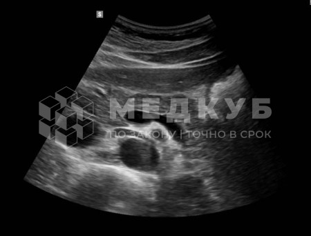 Аппарат УЗИ НПО Сканер РуСкан 65М medcub