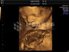 Аппарат УЗИ (сканер) GE Healthcare Voluson P8 medcub