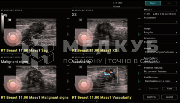 УЗИ-аппарат (сканер) Mindray Imagyn I9 medcub