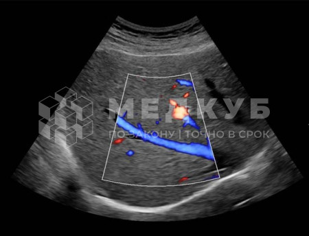 Аппарат УЗИ НПО Сканер РуСкан 65 medcub
