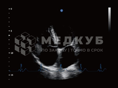 Аппарат УЗИ (сканер) Chison QBit 5 medcub