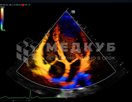 Аппарат УЗИ (сканер) Mindray Resona 7s medcub