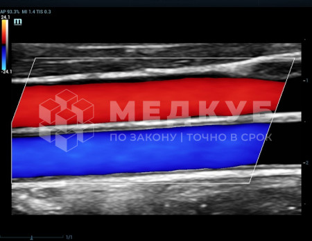 Аппарат УЗИ (сканер) Mindray Resona 7s medcub