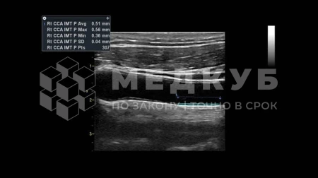 Аппарат УЗИ (сканер) GE Healthcare Vivid T8 medcub