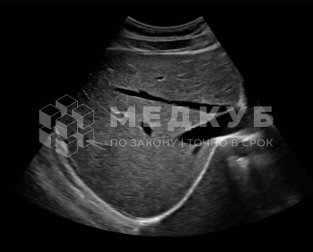 Аппарат УЗИ НПО Сканер РуСкан 65 medcub