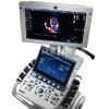 Аппарат УЗИ (сканер) GE Healthcare Vivid S70N medcub