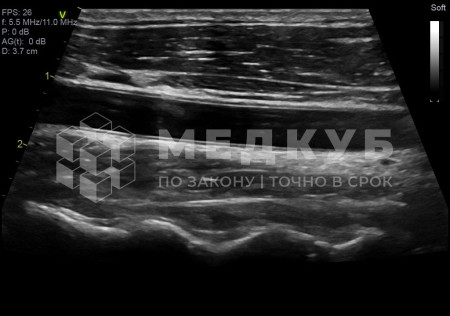 Аппарат УЗИ (сканер) GE Healthcare Vivid E95 medcub