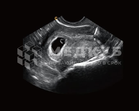 Аппарат УЗИ (сканер) Chison Qbit 8 medcub