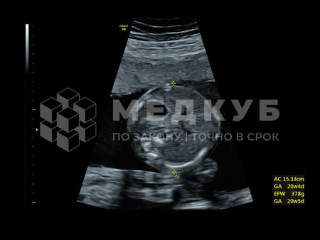 Аппарат УЗИ (сканер) GE Healthcare Voluson S10 medcub