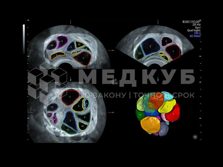 Аппарат УЗИ (сканер) GE Healthcare Voluson S10 medcub