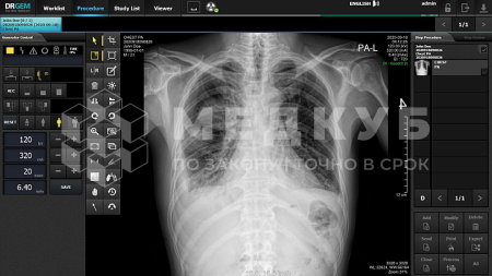 Рентген-аппарат цифровой DRGEM GXR Lite стационарный на 2 рабочих места medcub