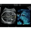 Аппарат УЗИ (сканер) GE Healthcare Voluson P8 medcub