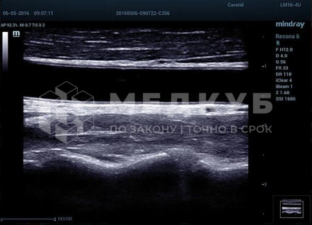 Аппарат УЗИ (сканер) Mindray Resona 7s medcub