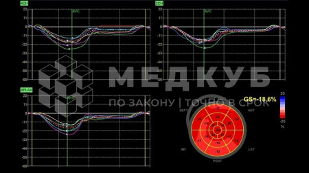Аппарат УЗИ (сканер) GE Healthcare Vivid T8 medcub