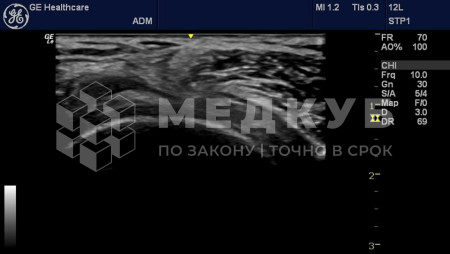 Аппарат УЗИ (сканер) GE Healthcare Logiq e medcub