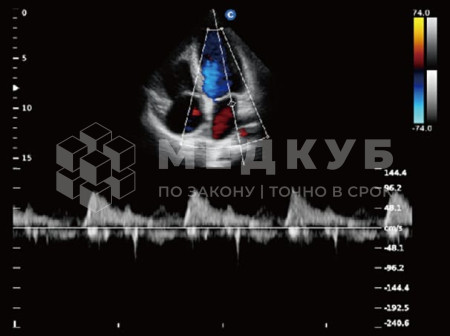 Аппарат УЗИ (сканер) Chison QBit 5 medcub