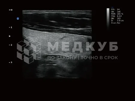 Аппарат УЗИ (сканер) Chison Qbit 3 medcub