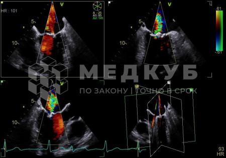 Аппарат УЗИ (сканер) GE Healthcare Vivid S70N medcub