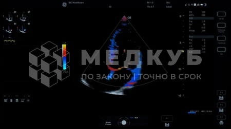 Аппарат УЗИ (сканер) GE Healthcare Versana Essential medcub