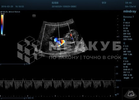 Аппарат УЗИ (сканер) Mindray Resona 7s medcub
