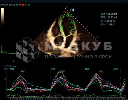 Аппарат УЗИ (сканер) Mindray Resona 7s medcub