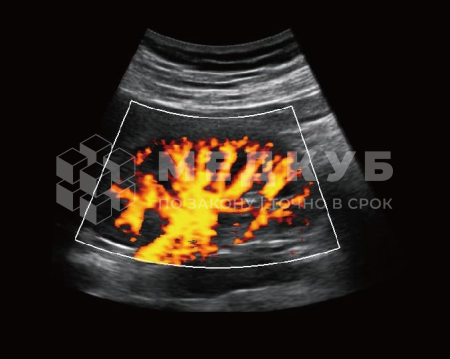 Аппарат УЗИ (сканер) Chison Qbit 8 medcub