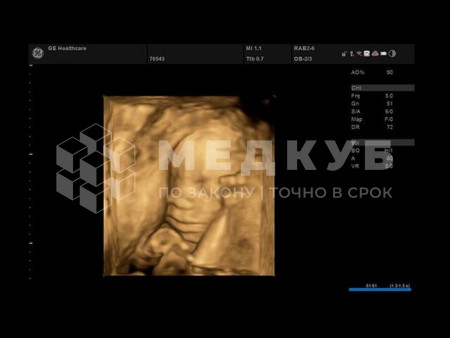 Аппарат УЗИ (сканер) GE Healthcare Versana Essential medcub