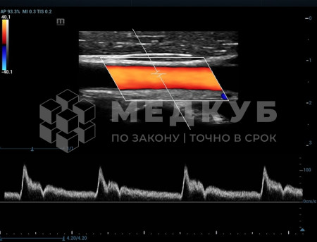 Аппарат УЗИ (сканер) Mindray Resona 7s medcub