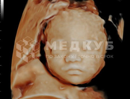Аппарат УЗИ (сканер) Mindray Resona 7s medcub