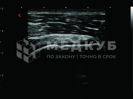 Аппарат УЗИ (сканер) Chison SonoTouch 80 Pro medcub