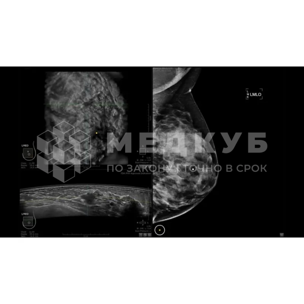 Аппарат УЗИ (сканер) GE Healthcare Invenia ABUS 2.0 medcub