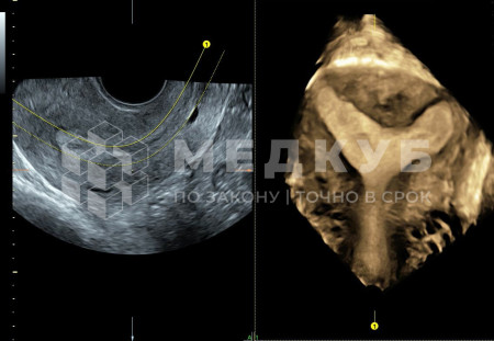 Аппарат УЗИ (сканер) GE Healthcare Voluson S10 medcub